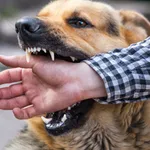 Bitten by a dog? Get legal assistance for dog bite claims.